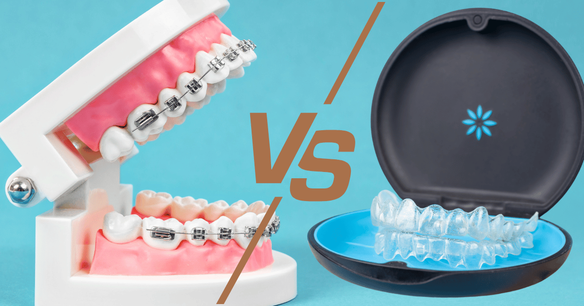 invisalign vs braces